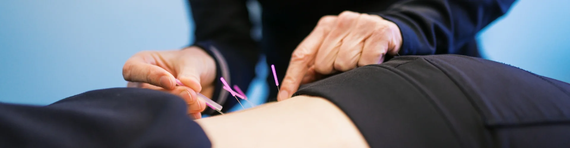 Dry Needling